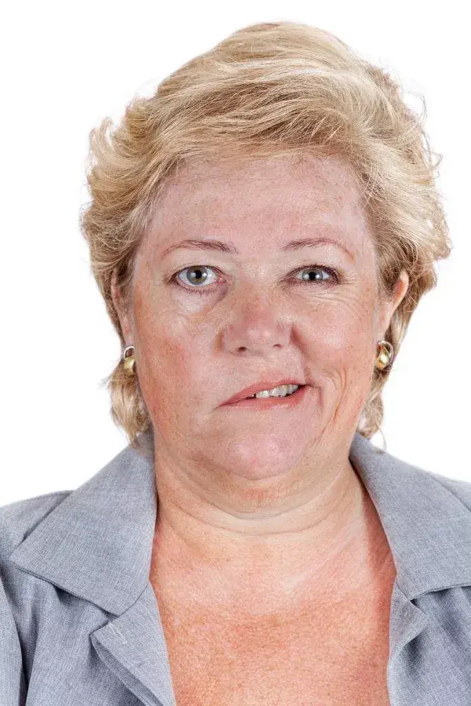 Porażenie nerwów twarzowego i trójdzielnego