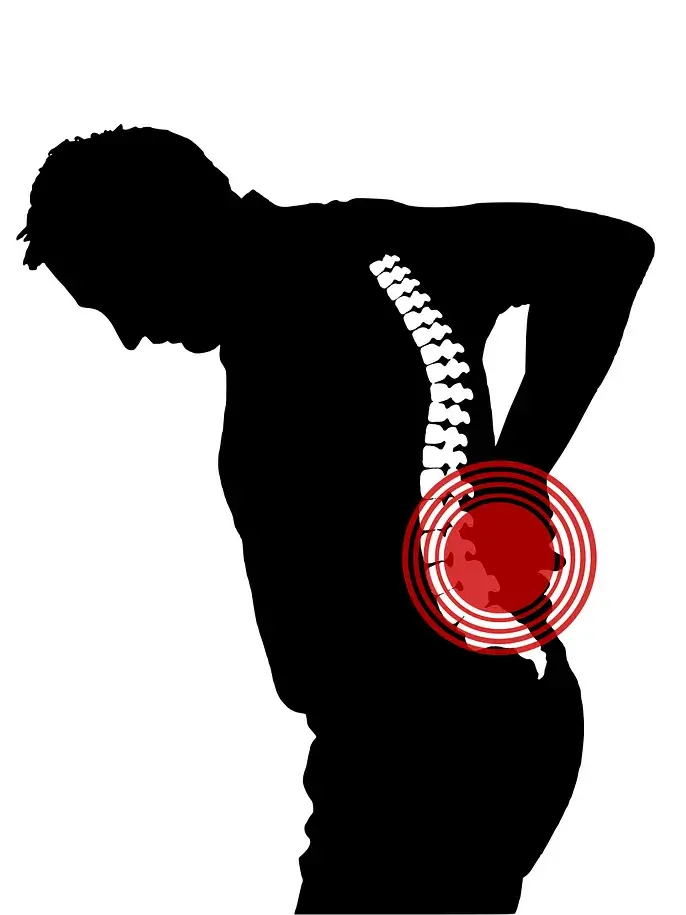 Rwa kulszowa ból kręgosłupa